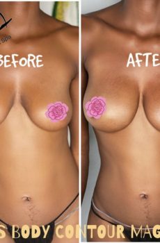 LFS BODY CONTOUR MAGIC